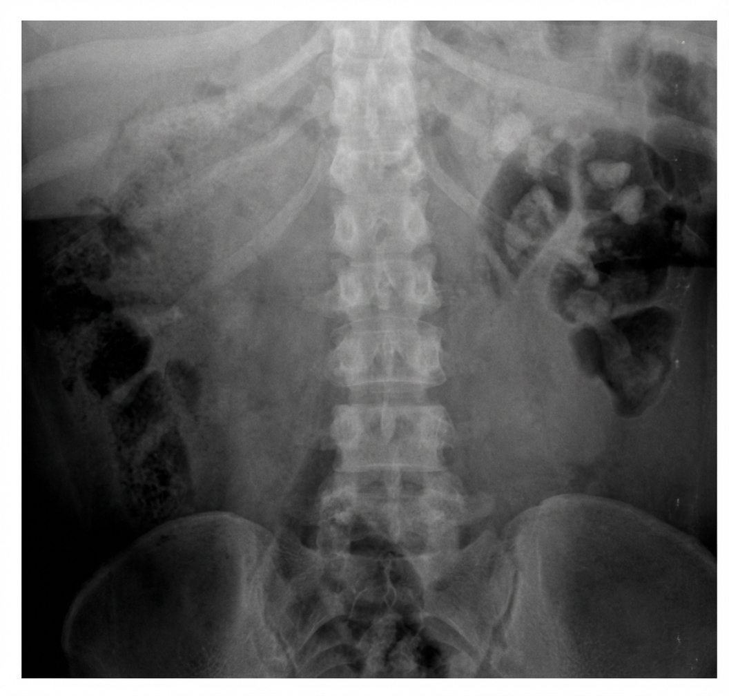 Imagem da questão de Litíase Renal