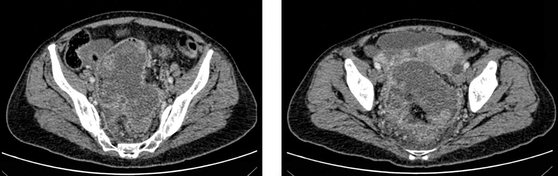 Imagem da questão de Coloproctologia
