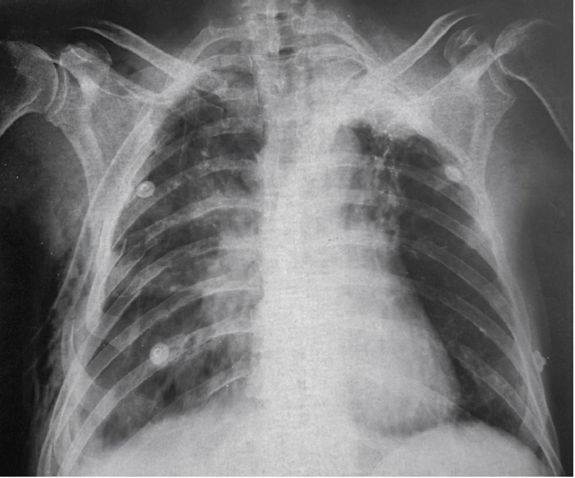 Imagem da questão de Trauma e Emergência
