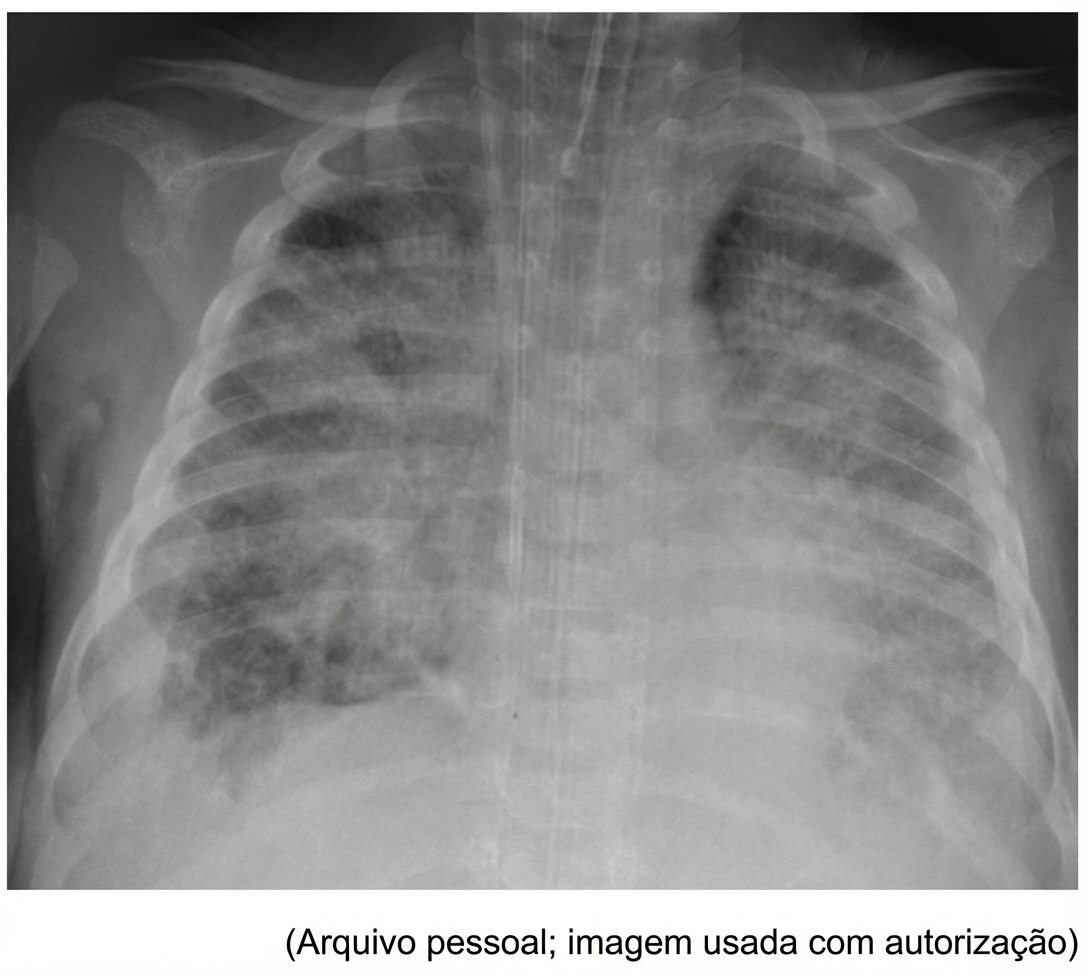 Imagem da questão de Ventilação Mecânica