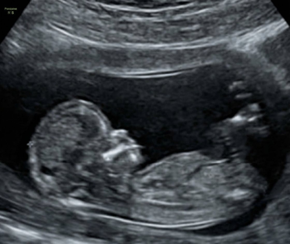 Imagem da questão de Diagnóstico por Imagem em Obstetrícia