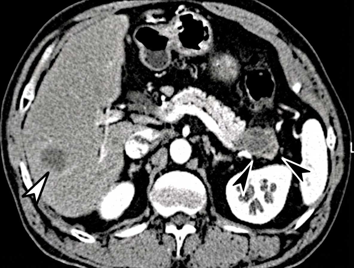 Imagem da questão de Doenças Pancreáticas