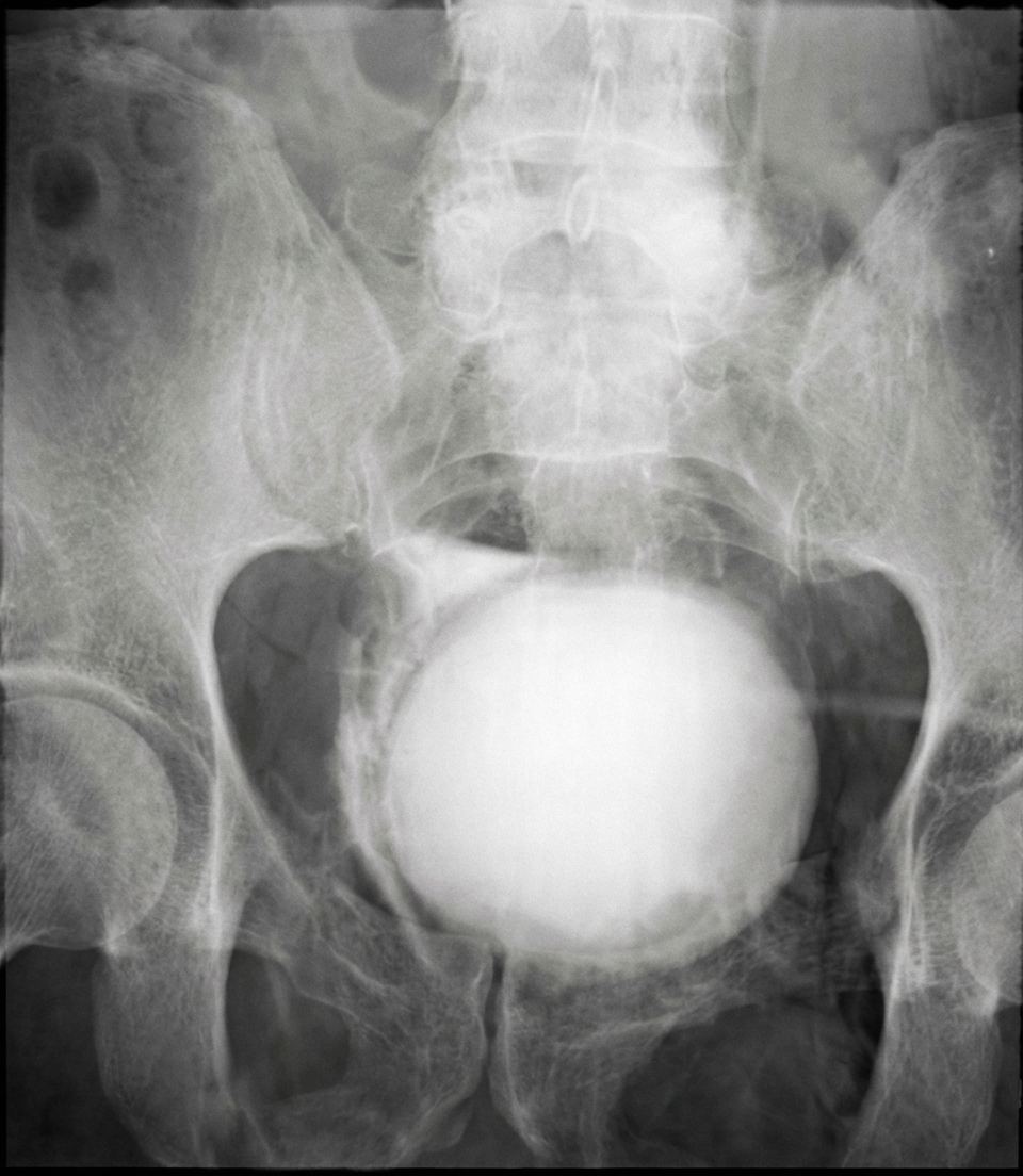 Imagem da questão de Trauma e Emergência