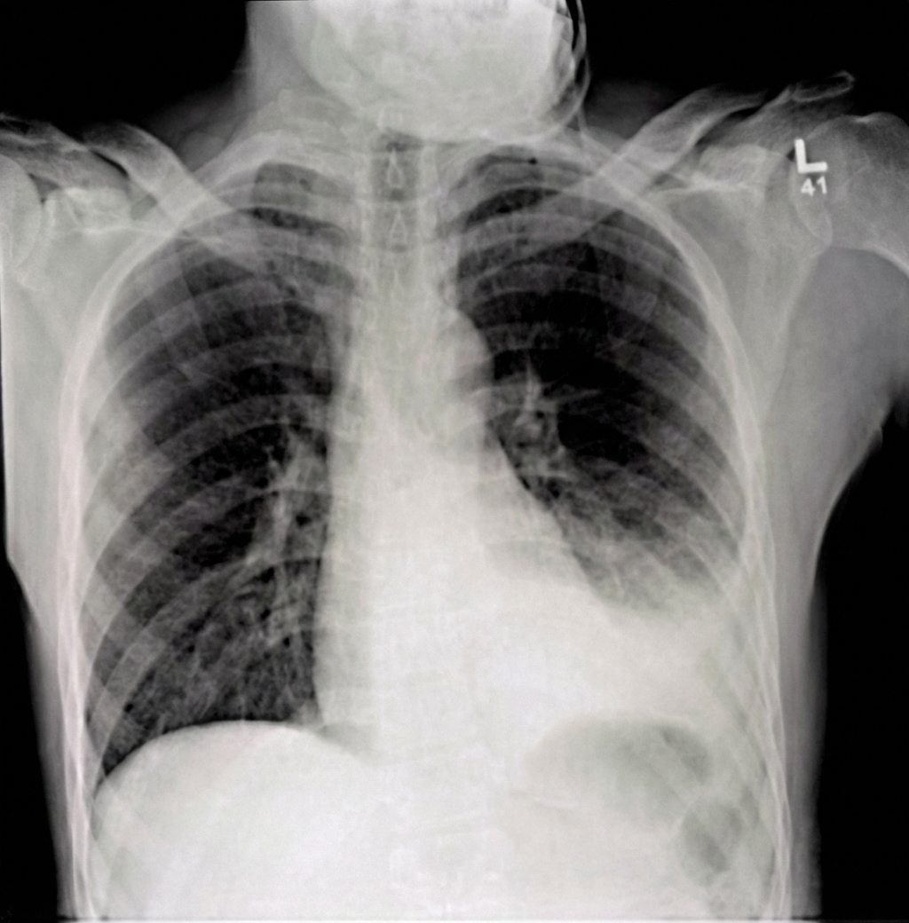 Imagem da questão de Trauma e Emergência