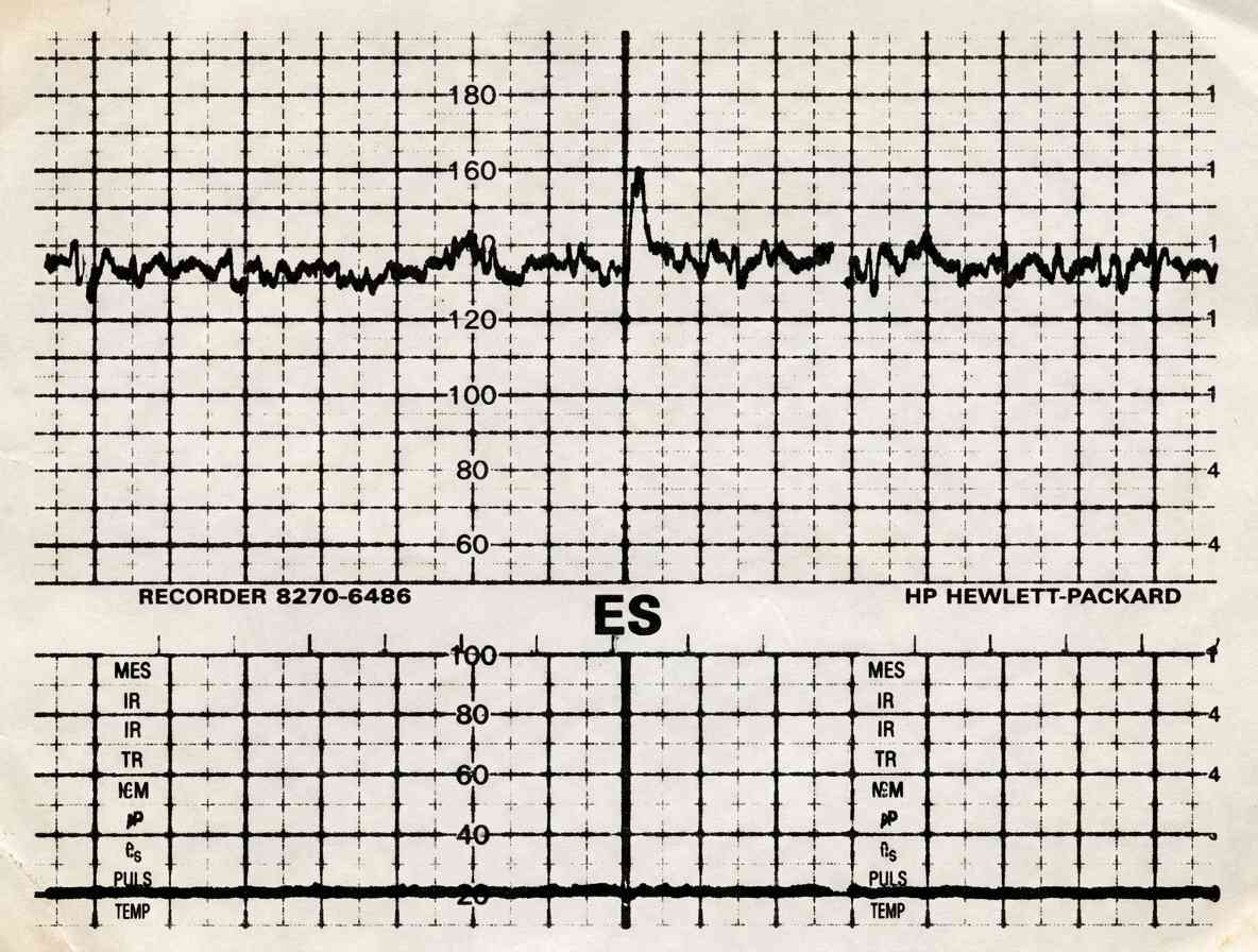 Imagem da questão de Monitorização Fetal