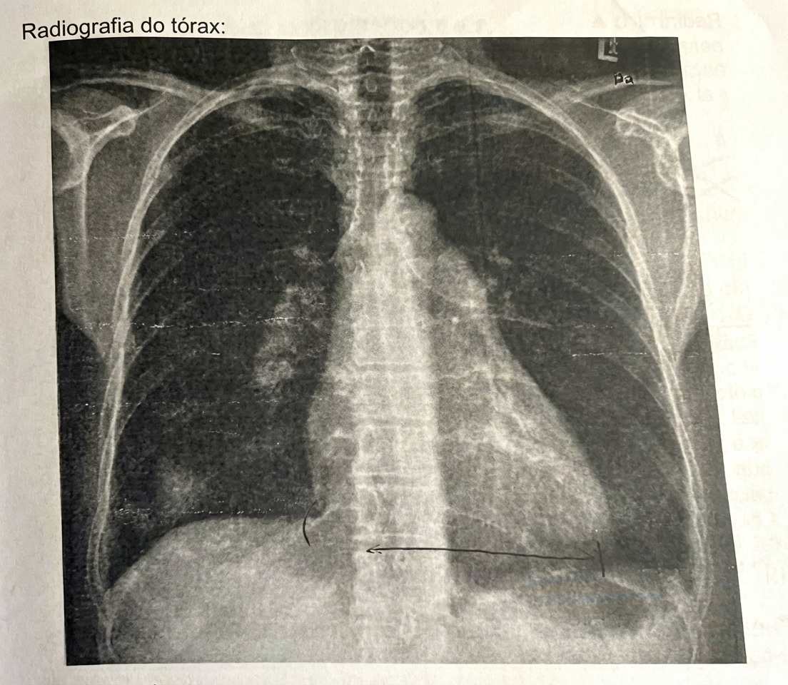 Imagem da questão de Artrites Inflamatórias