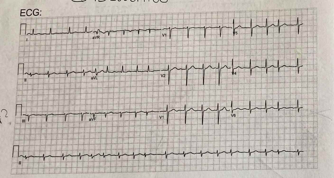 Imagem da questão de Doenças Cerebrovasculares