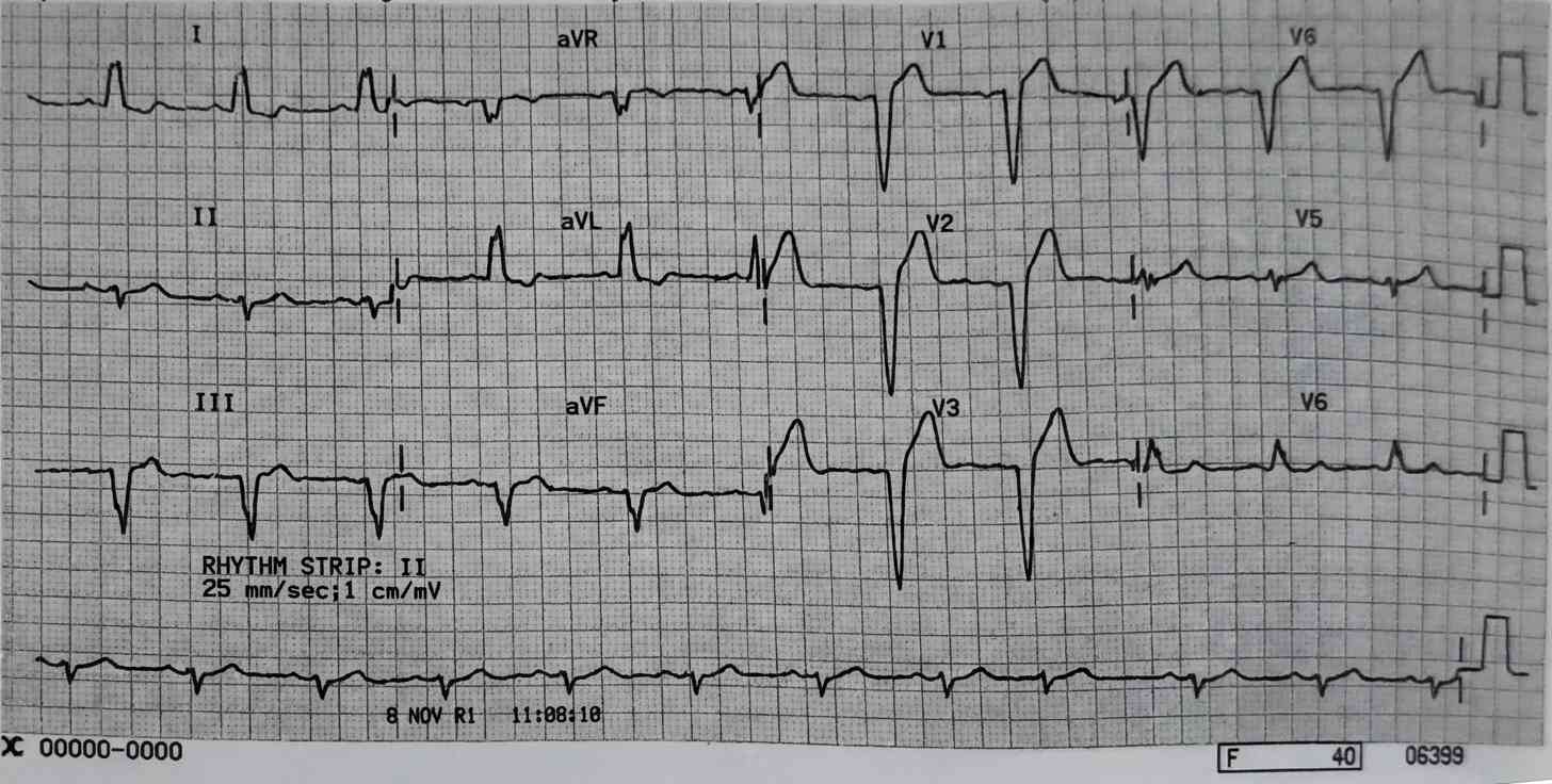 Imagem da questão de Eletrocardiograma (ECG)