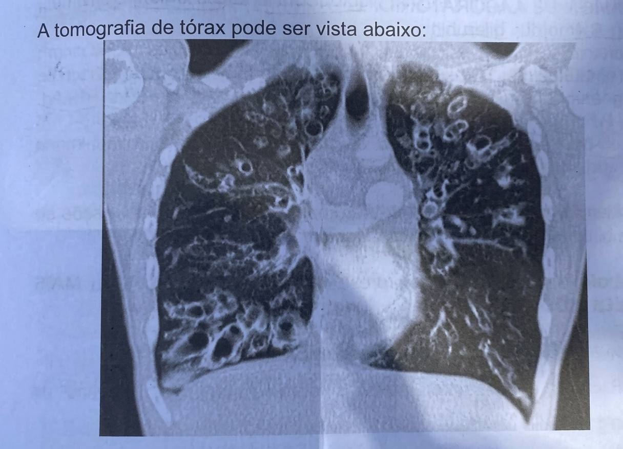 Imagem da questão de Doenças Obstrutivas das Vias Aéreas