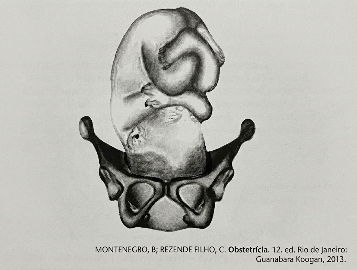 Imagem da questão de Biomecânica do Parto