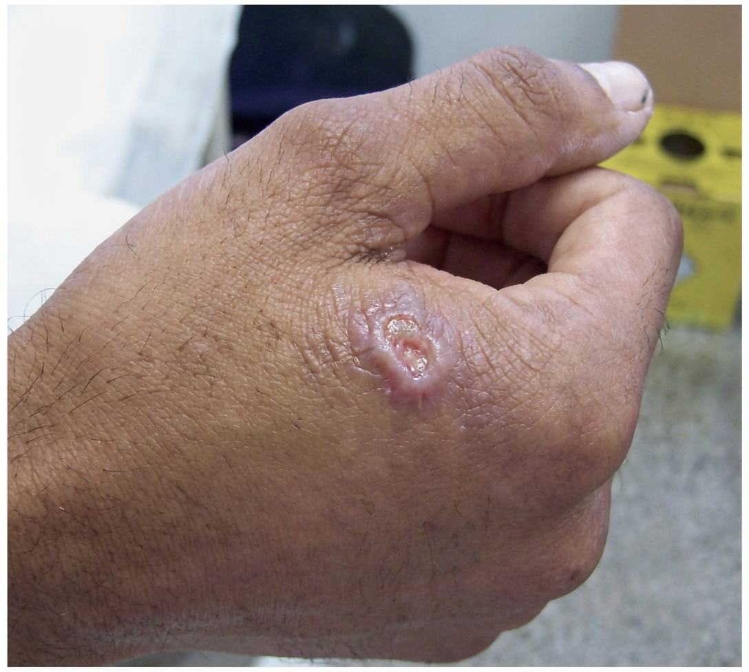 Imagem da questão de Zoonoses