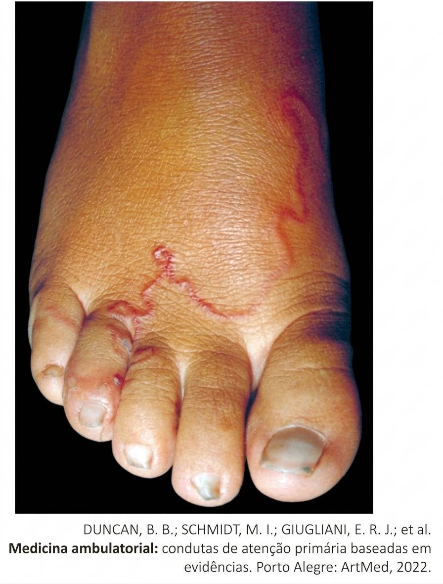 Imagem da questão de Infecções Cutâneas