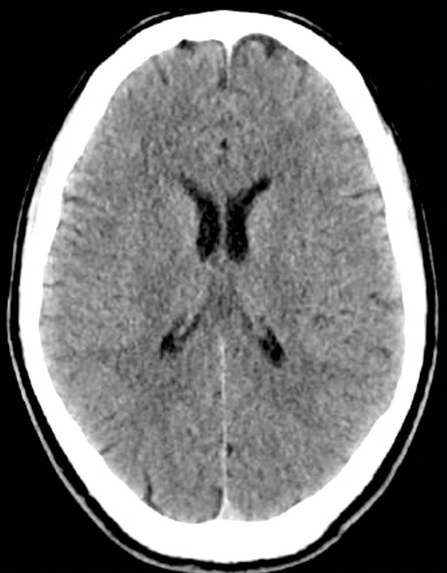 Imagem da questão de Síndromes Cognitivas