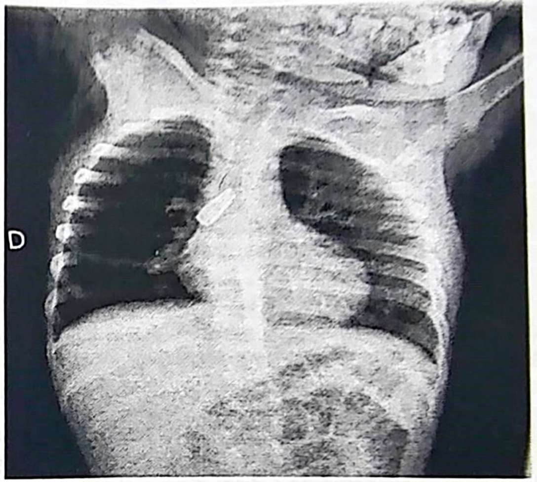 Imagem da questão de Trauma e Emergência