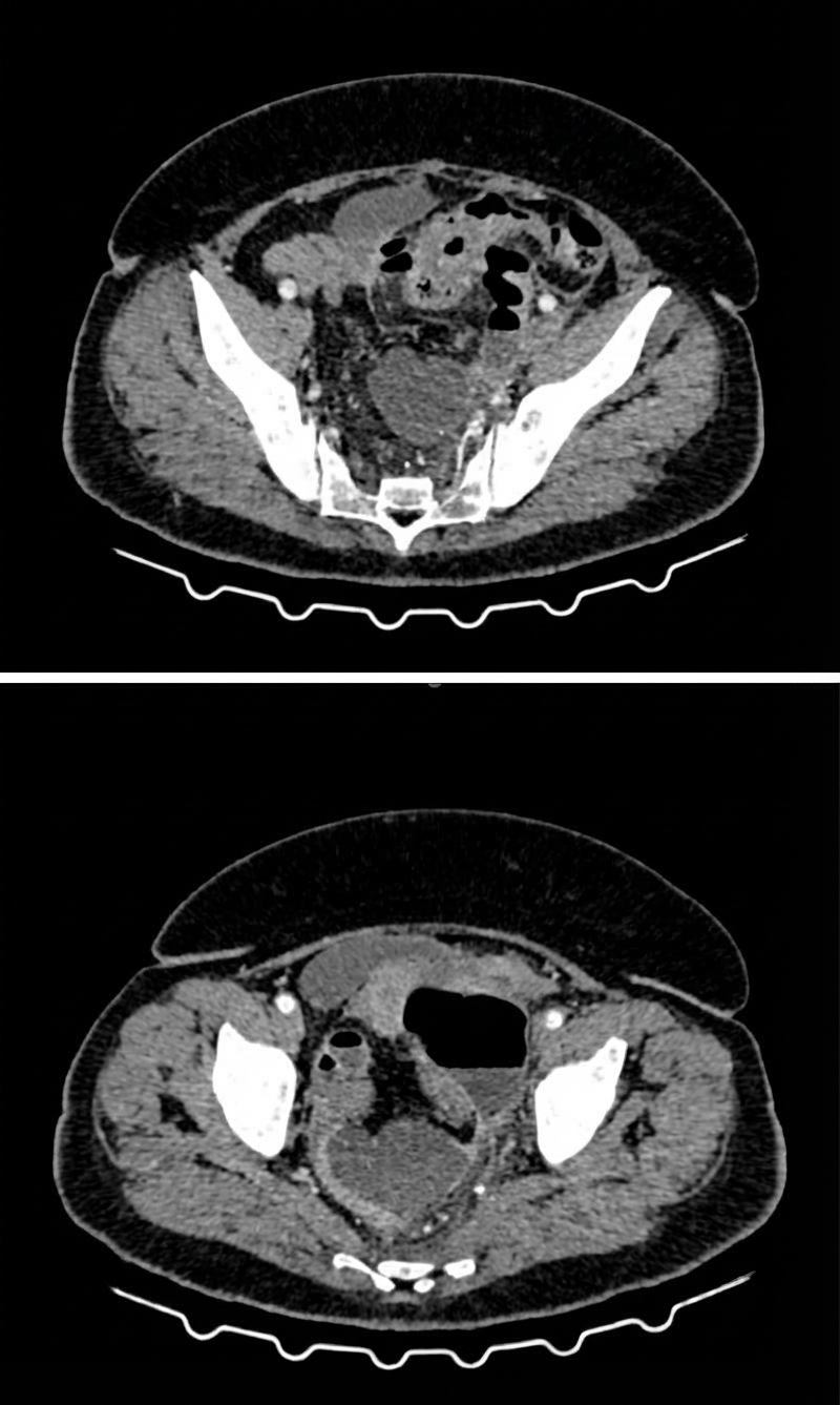 Imagem da questão de Coloproctologia
