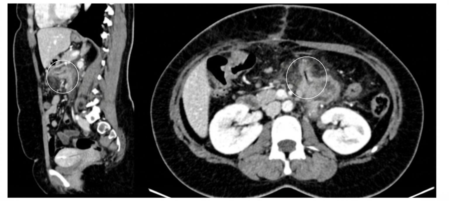 Imagem da questão de Emergências Gastrointestinais