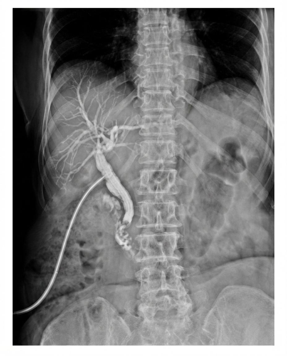 Imagem da questão de Pancreatobiliar