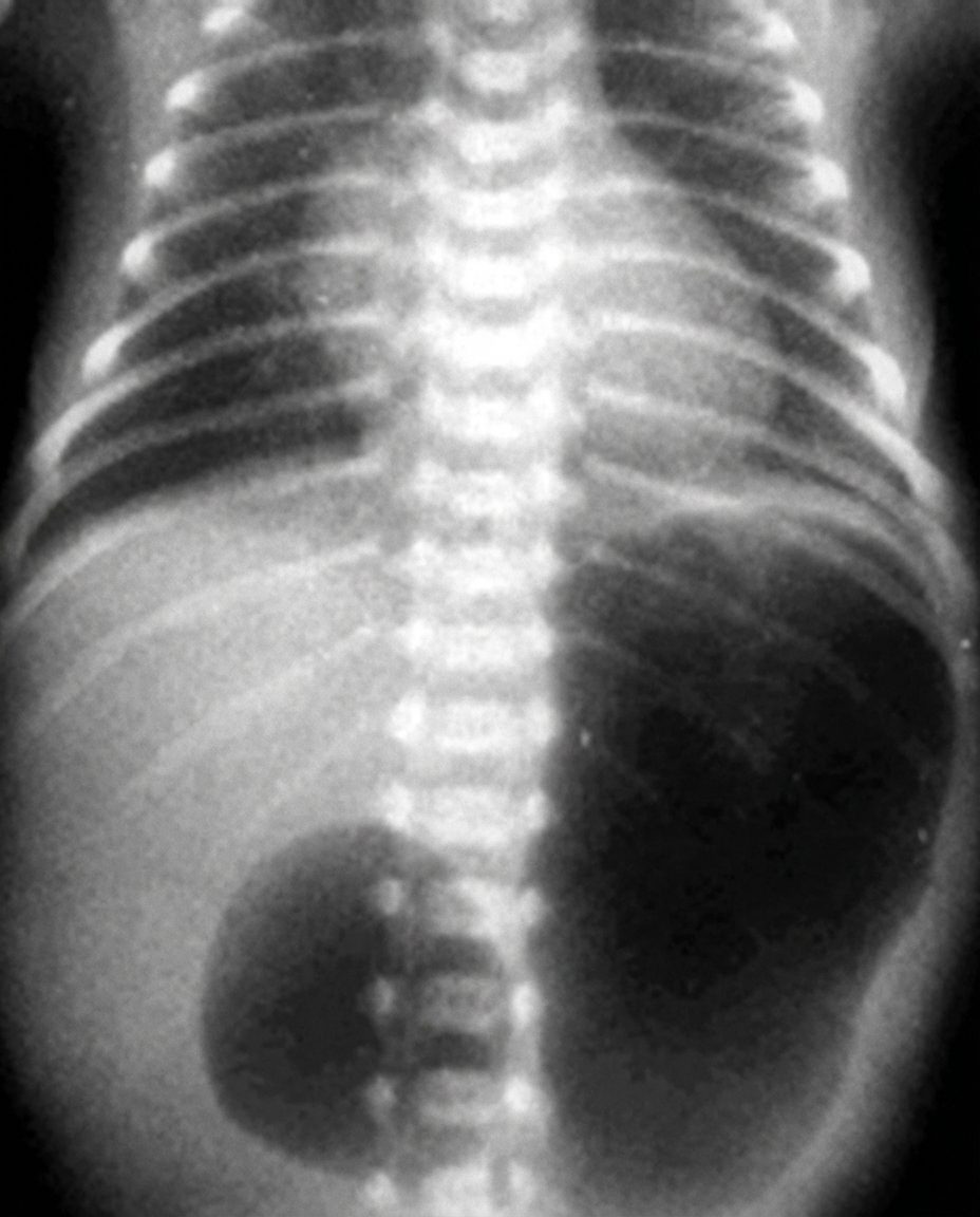 Imagem da questão de Cirurgia Neonatal e Emergências
