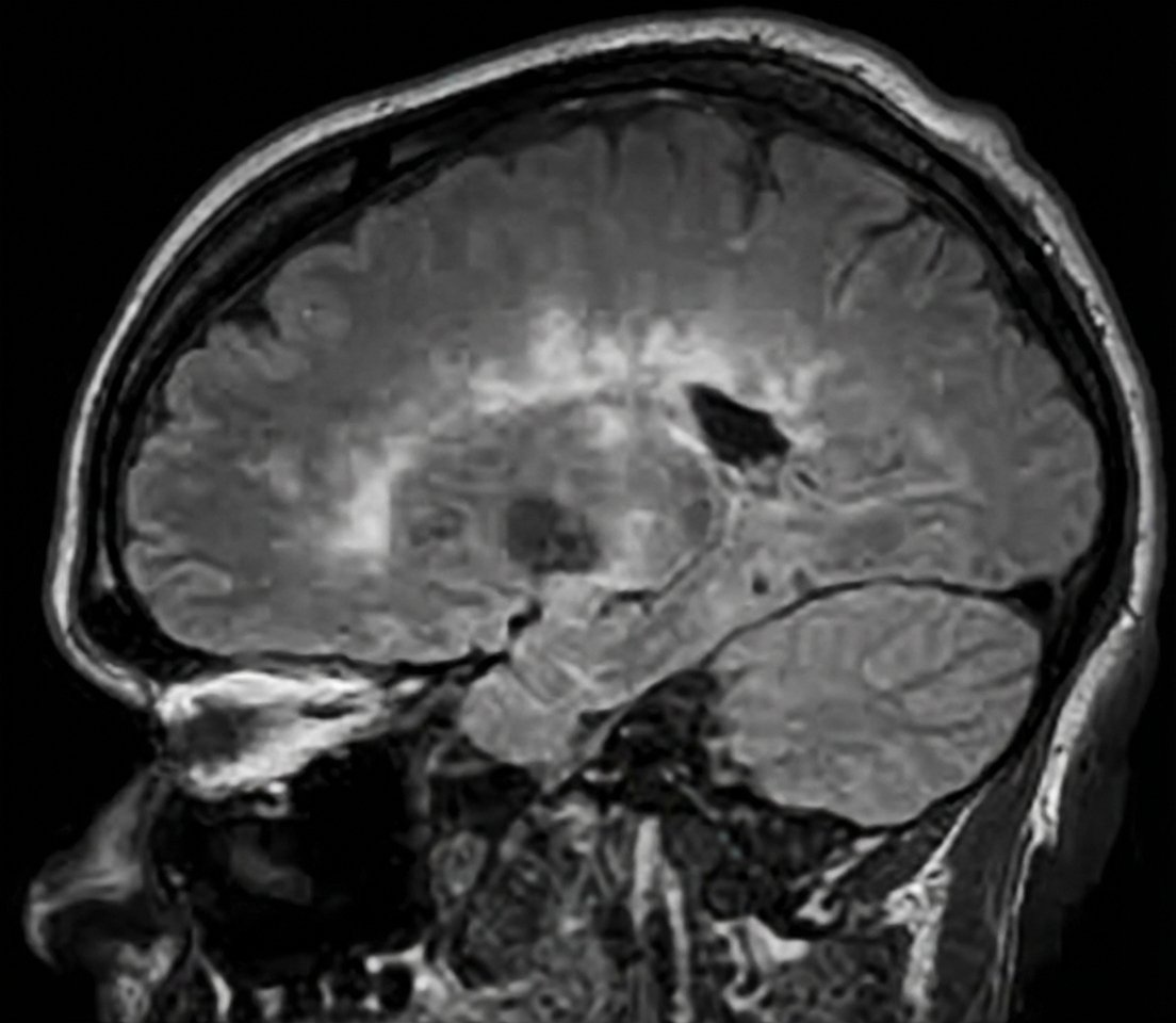 Imagem da questão de Doenças Neuroimunológicas