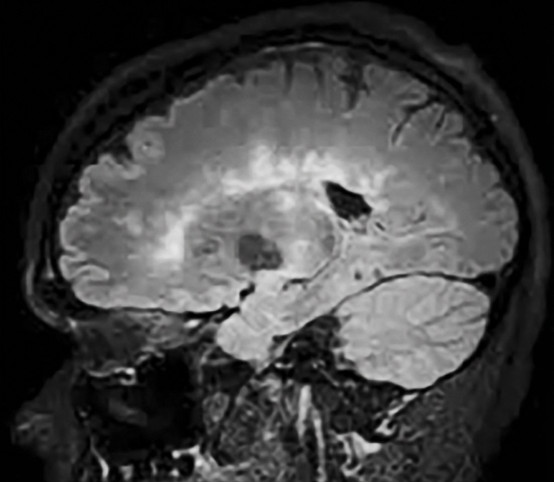 Imagem da questão de Doenças Neuroimunológicas