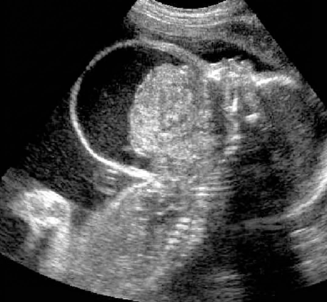 Imagem da questão de Diagnóstico por Imagem em Obstetrícia