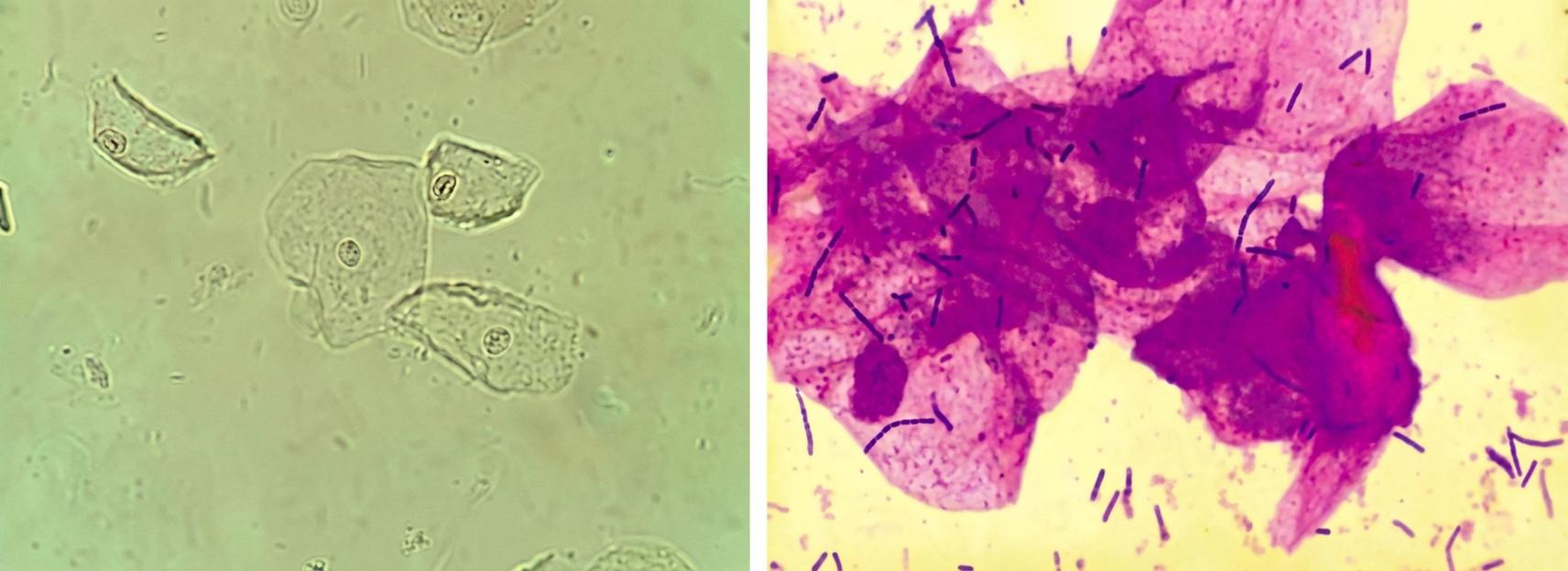 Imagem da questão de Infecções do trato genital