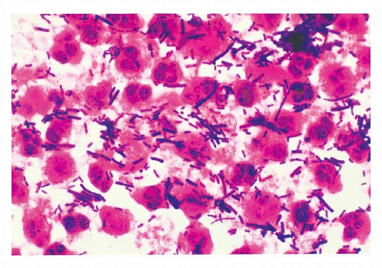 Imagem da questão de Infecções do trato genital