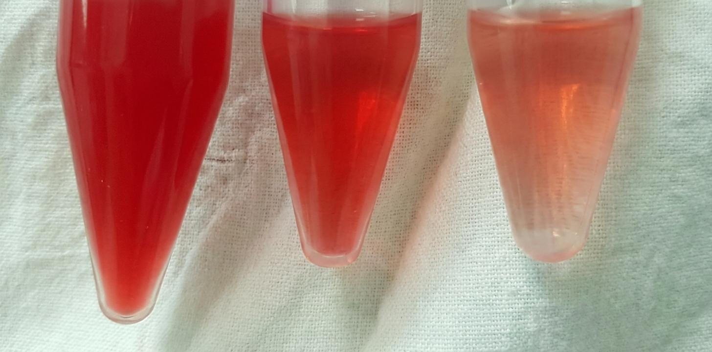 Imagem da questão de Doenças Cerebrovasculares