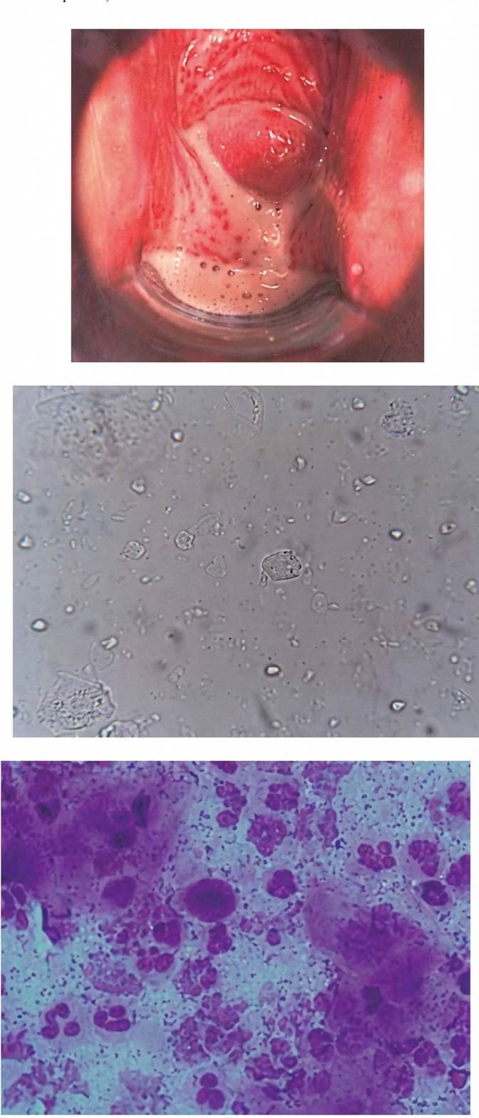 Imagem da questão de Infecções do trato genital