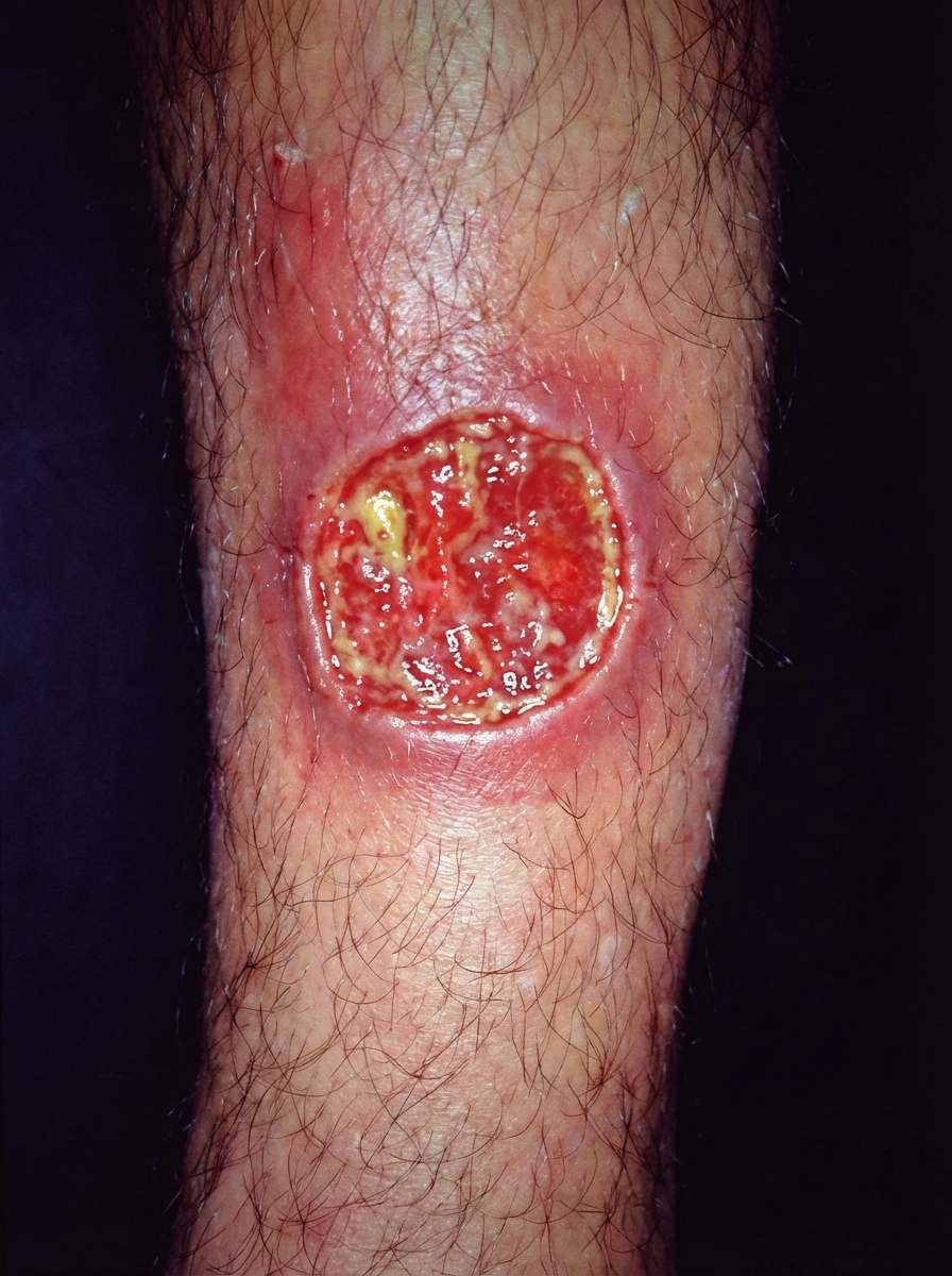 Imagem da questão de Zoonoses