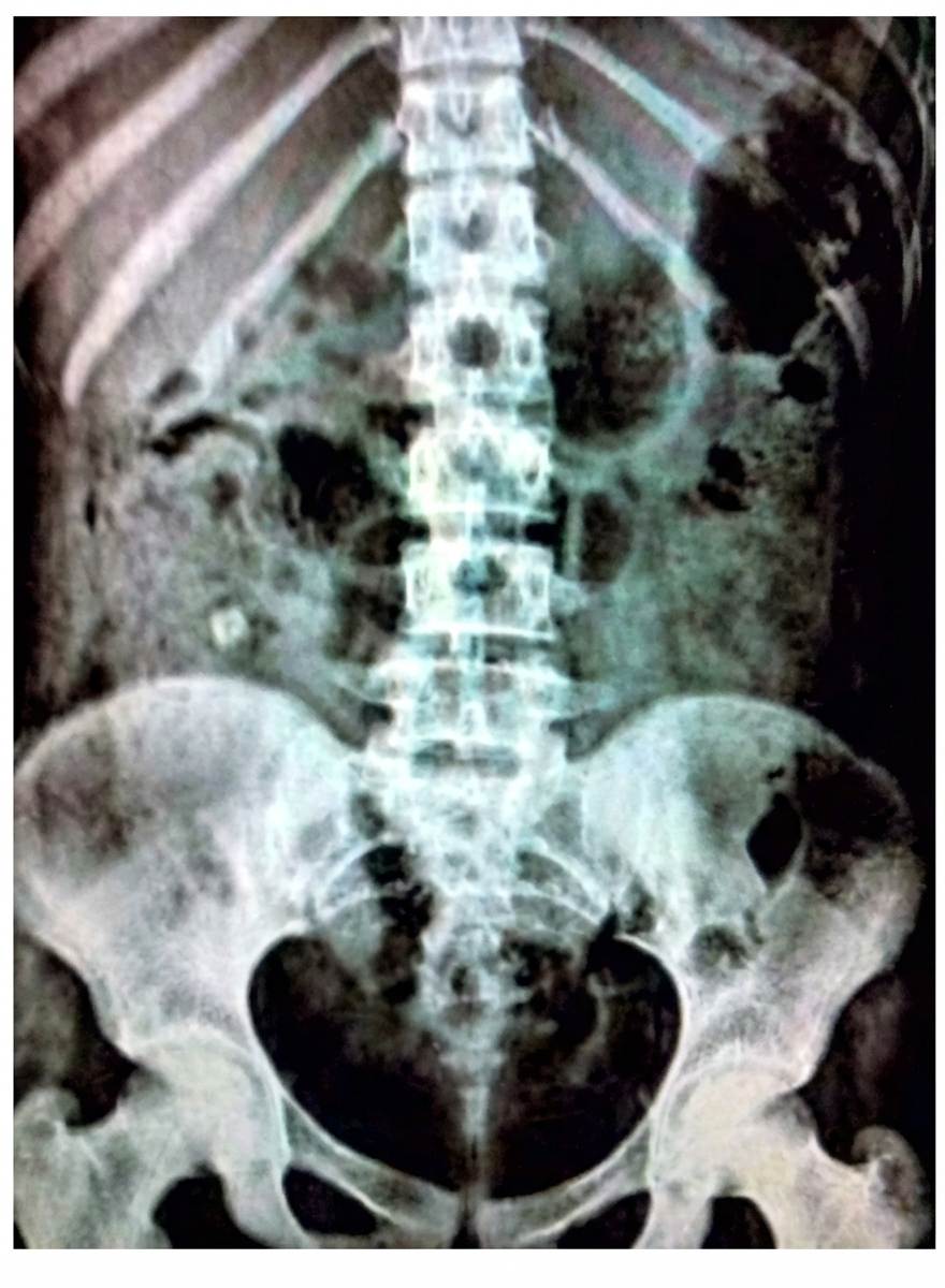 Imagem da questão de Emergências Gastrointestinais