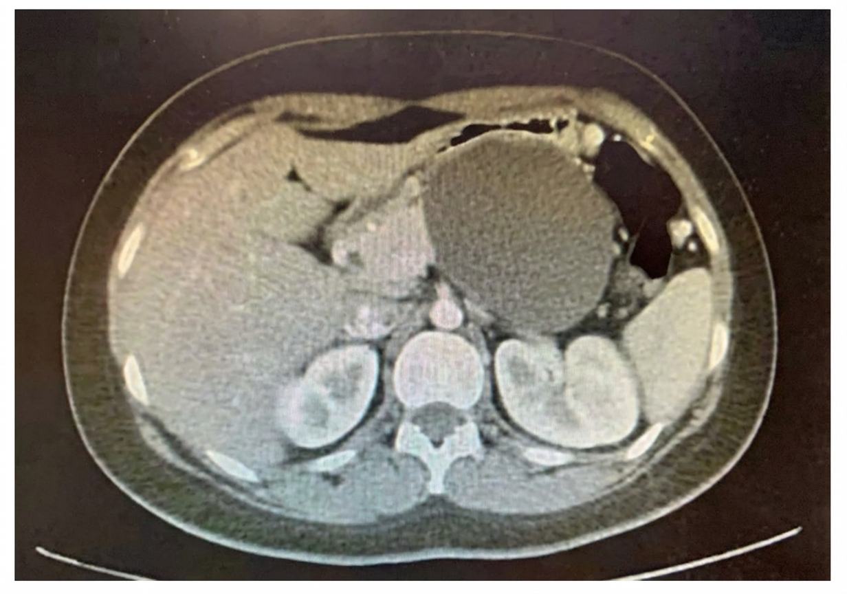 Imagem da questão de Pancreatobiliar
