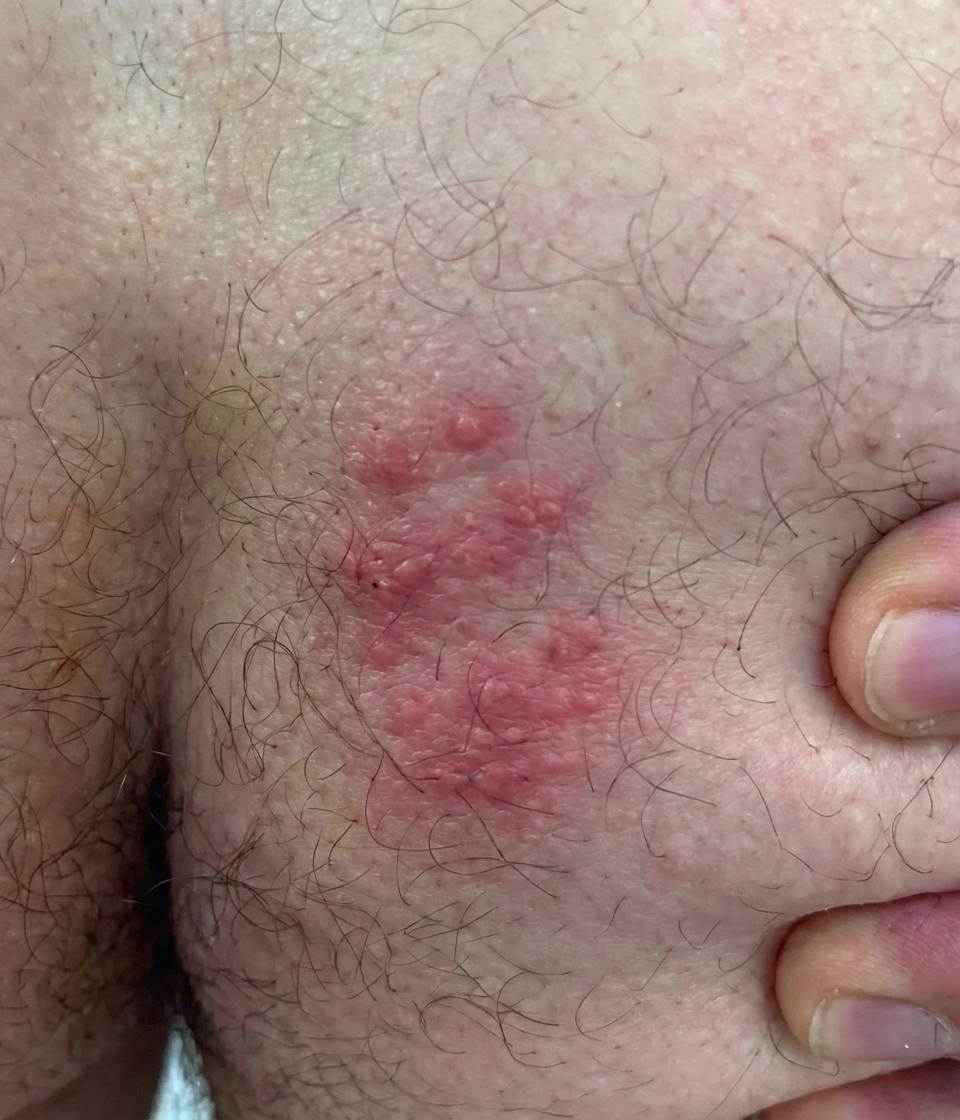 Imagem da questão de Doenças Virais