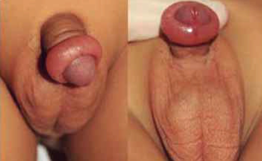 Imagem da questão de Urologia Pediátrica