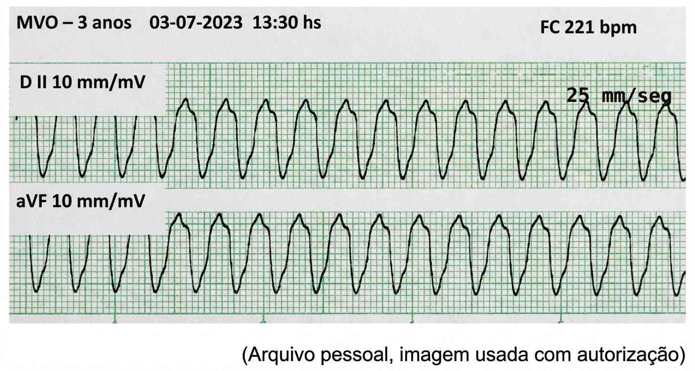 Imagem da questão de Choque