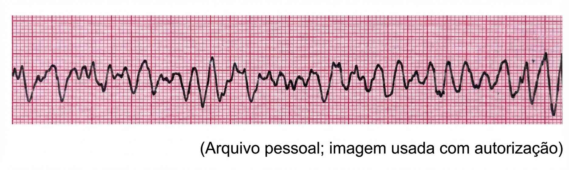 Imagem da questão de Suporte Avançado de Vida