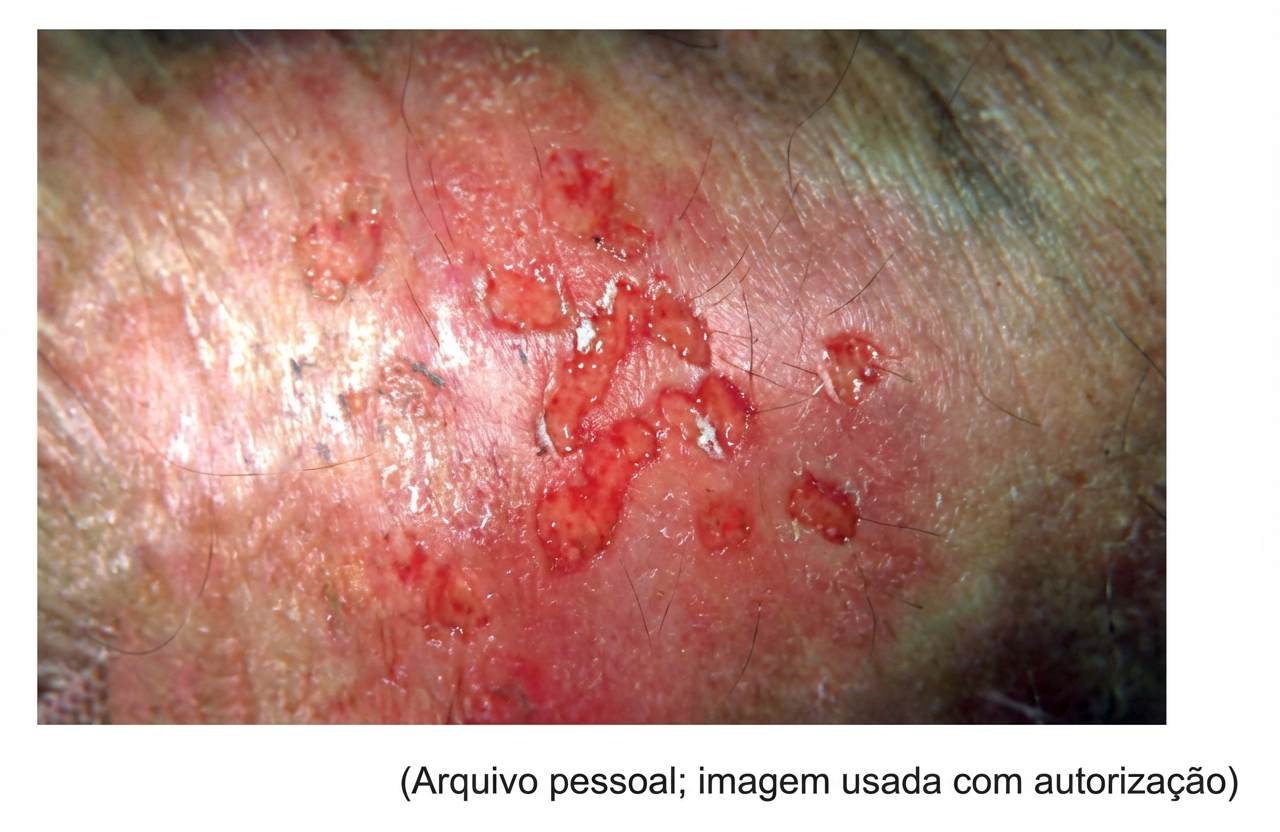 Imagem da questão de Doenças Sexualmente Transmissíveis (DSTs)