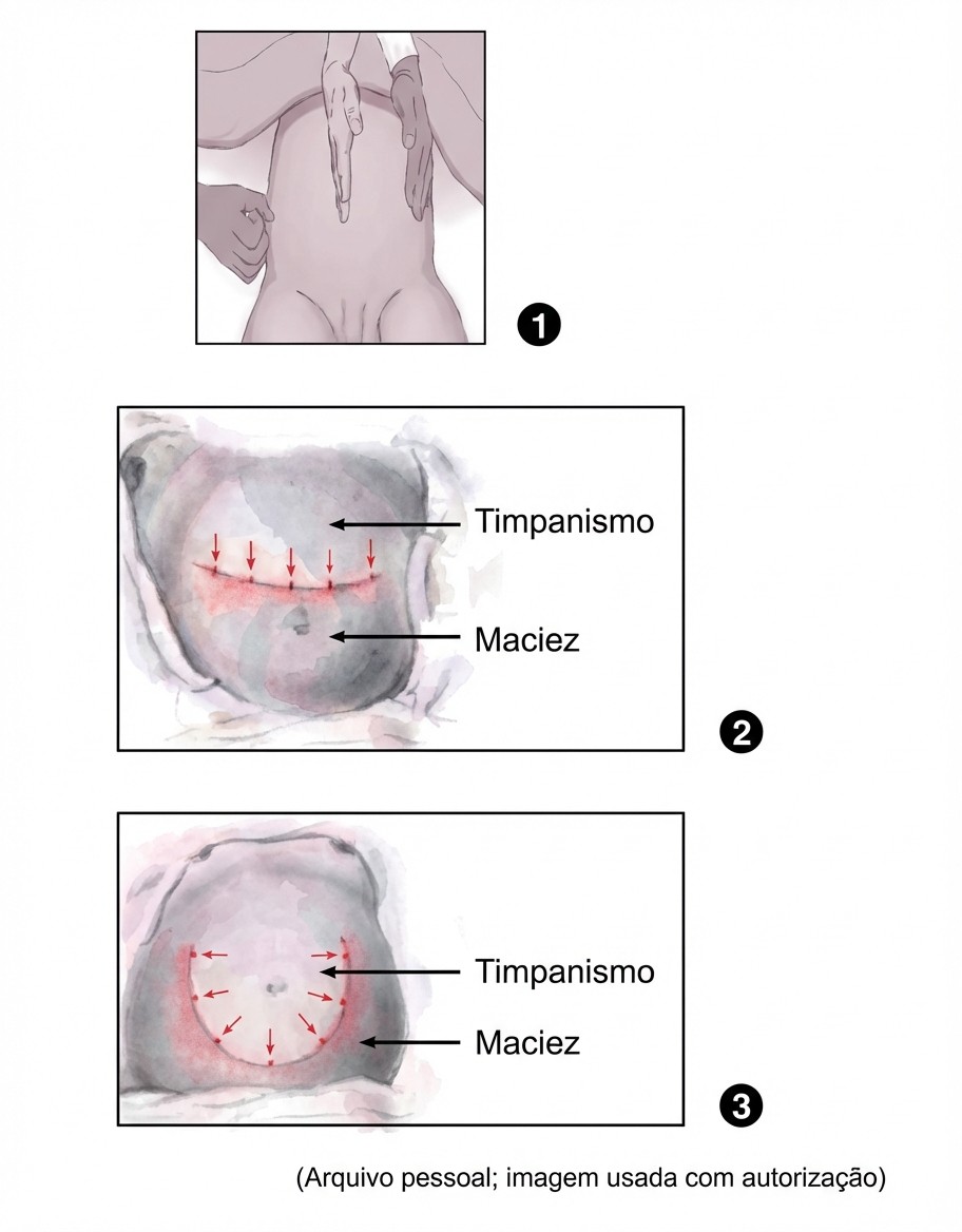 Imagem da questão de Síndromes Nefrológicas