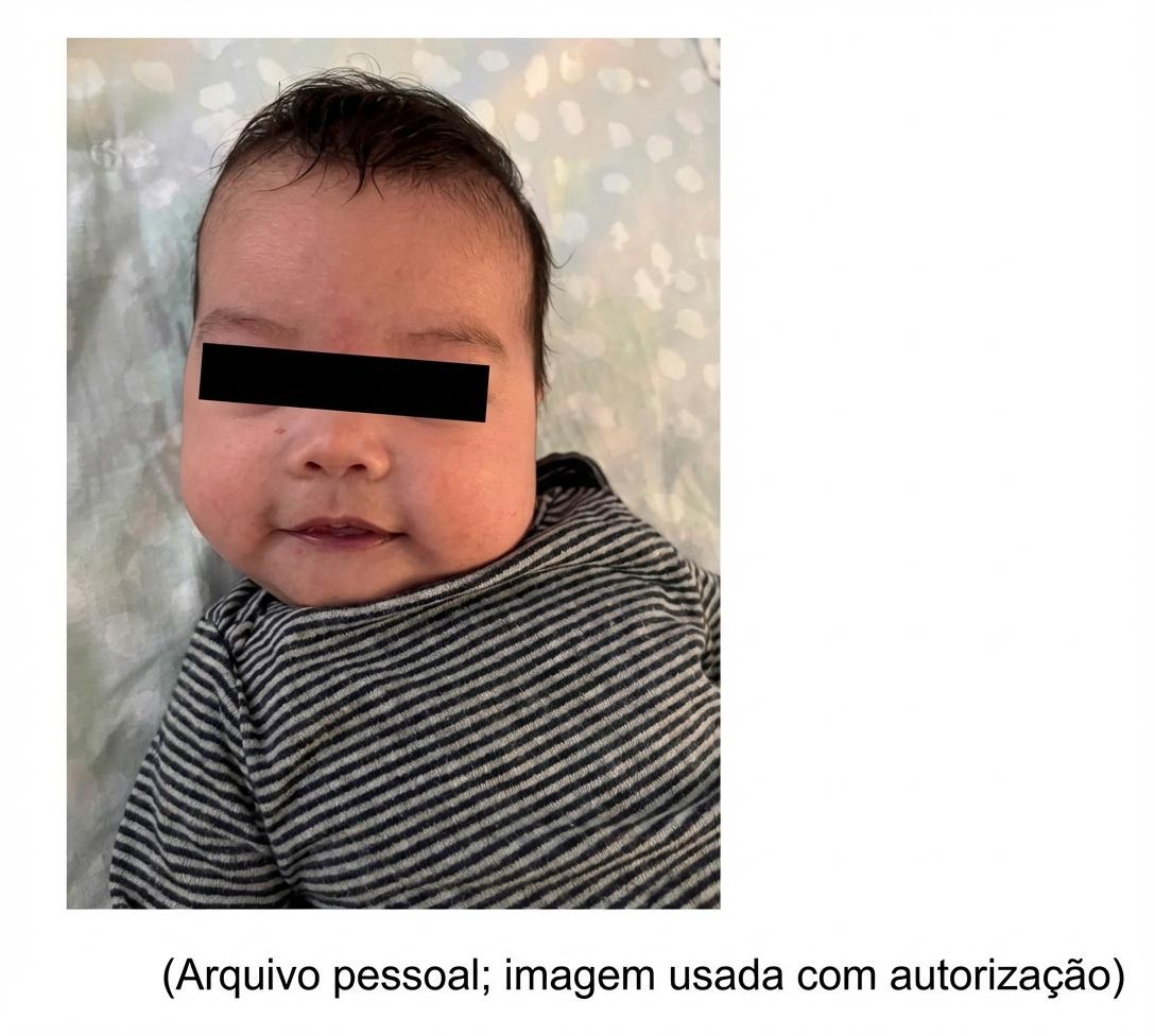 Imagem da questão de Cirurgia Pediátrica Cervical