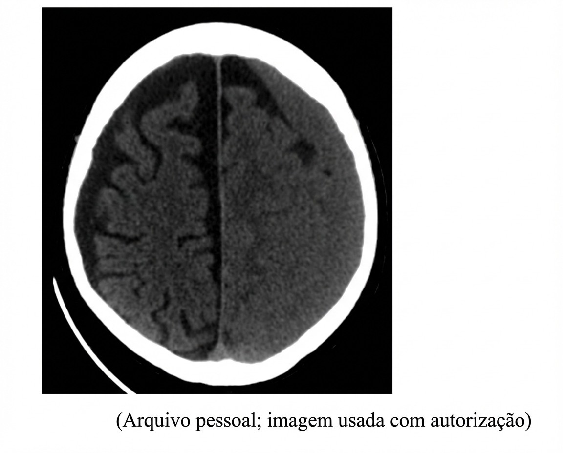 Imagem da questão de Trauma Cranioencefálico (TCE)