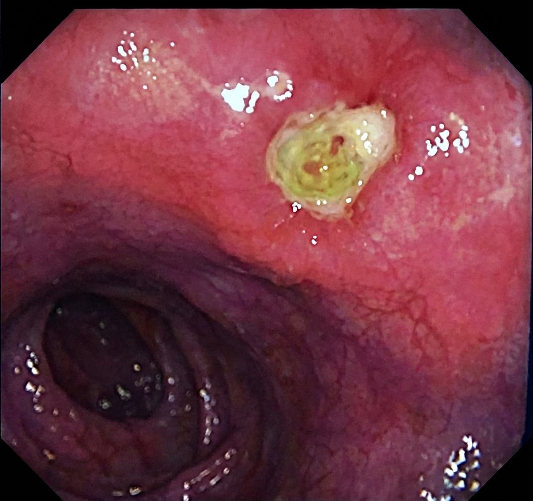 Imagem da questão de Emergências Gastrointestinais