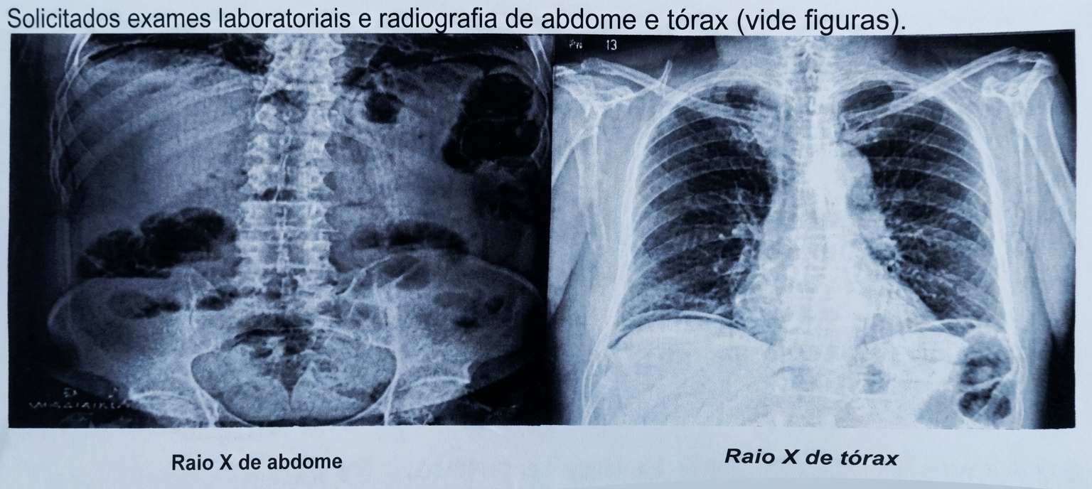 Imagem da questão de Abdome Agudo