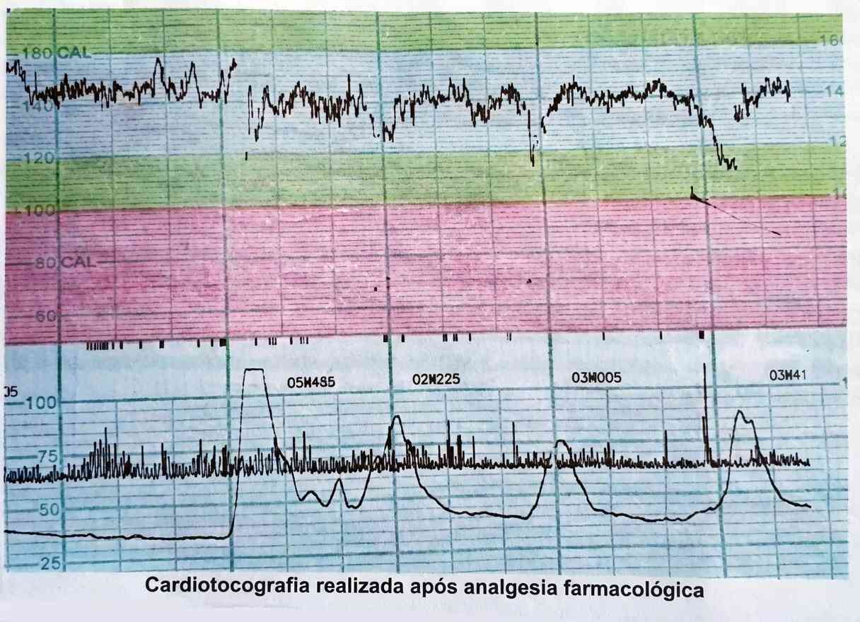 Imagem da questão de Atendimento ao Trabalho de Parto