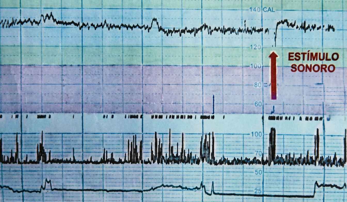 Imagem da questão de Alterações do Crescimento Fetal