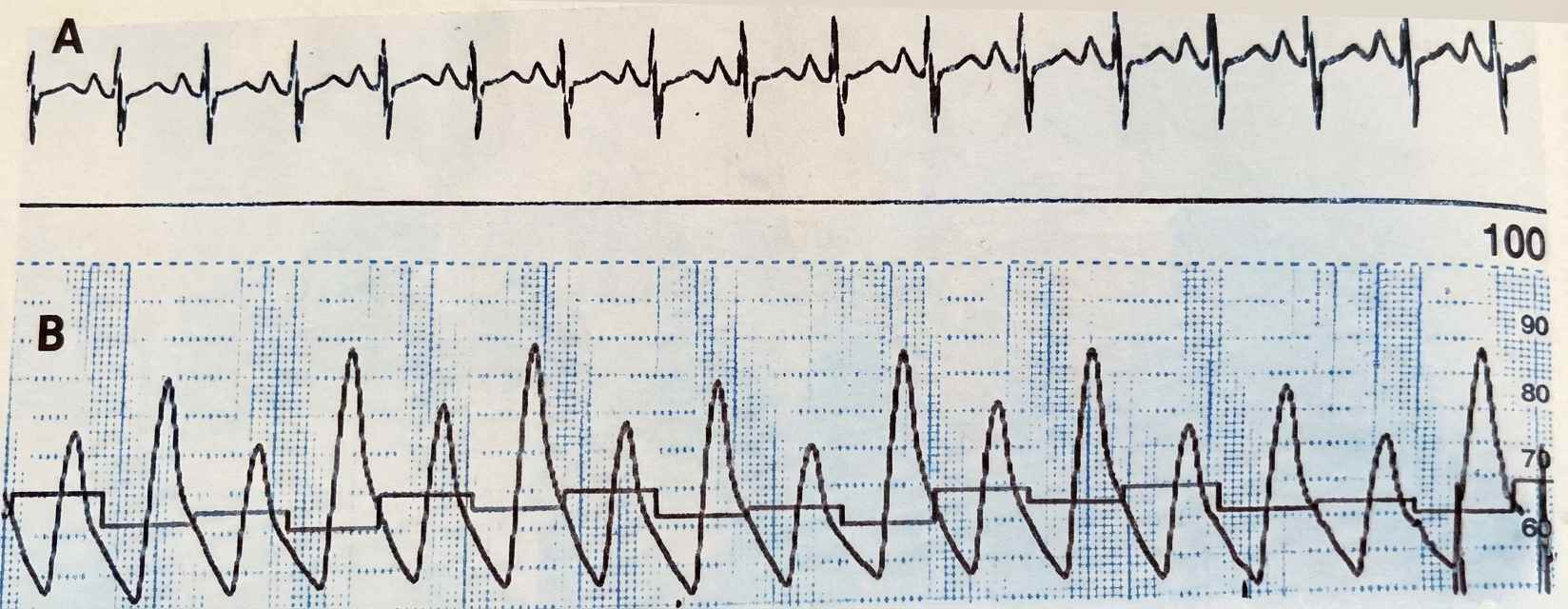 Imagem da questão de Insuficiência Cardíaca (IC)
