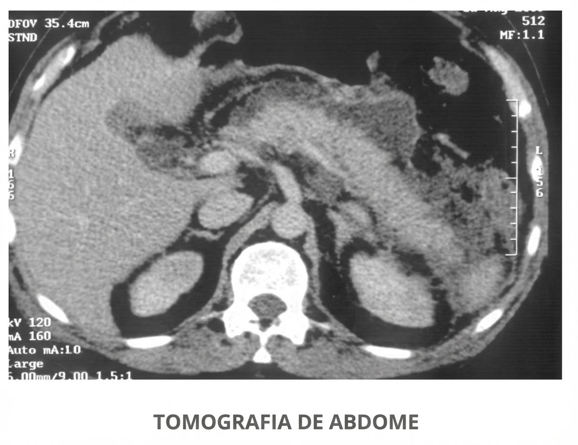 Imagem da questão de Abdome Agudo