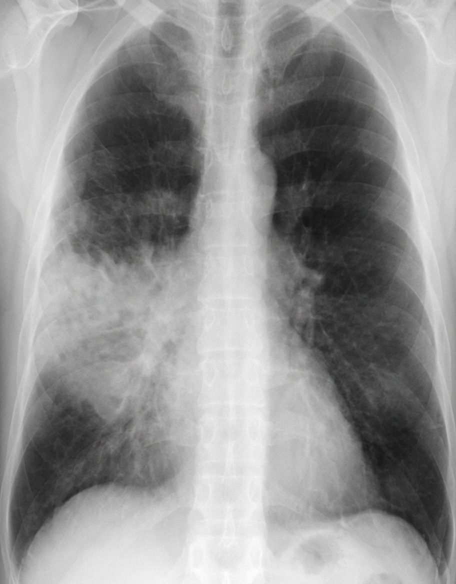 Imagem da alternativa B