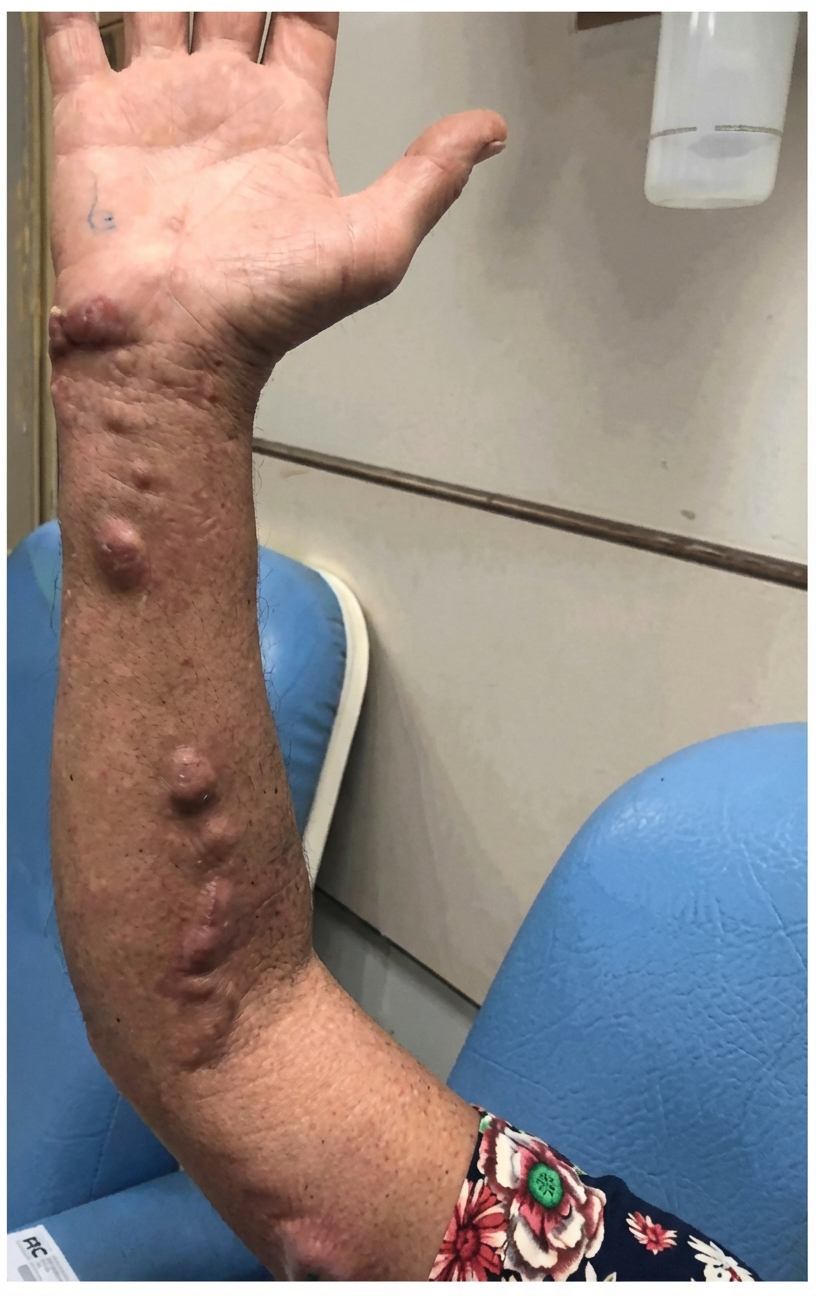 Imagem da questão de Infecções Cutâneas