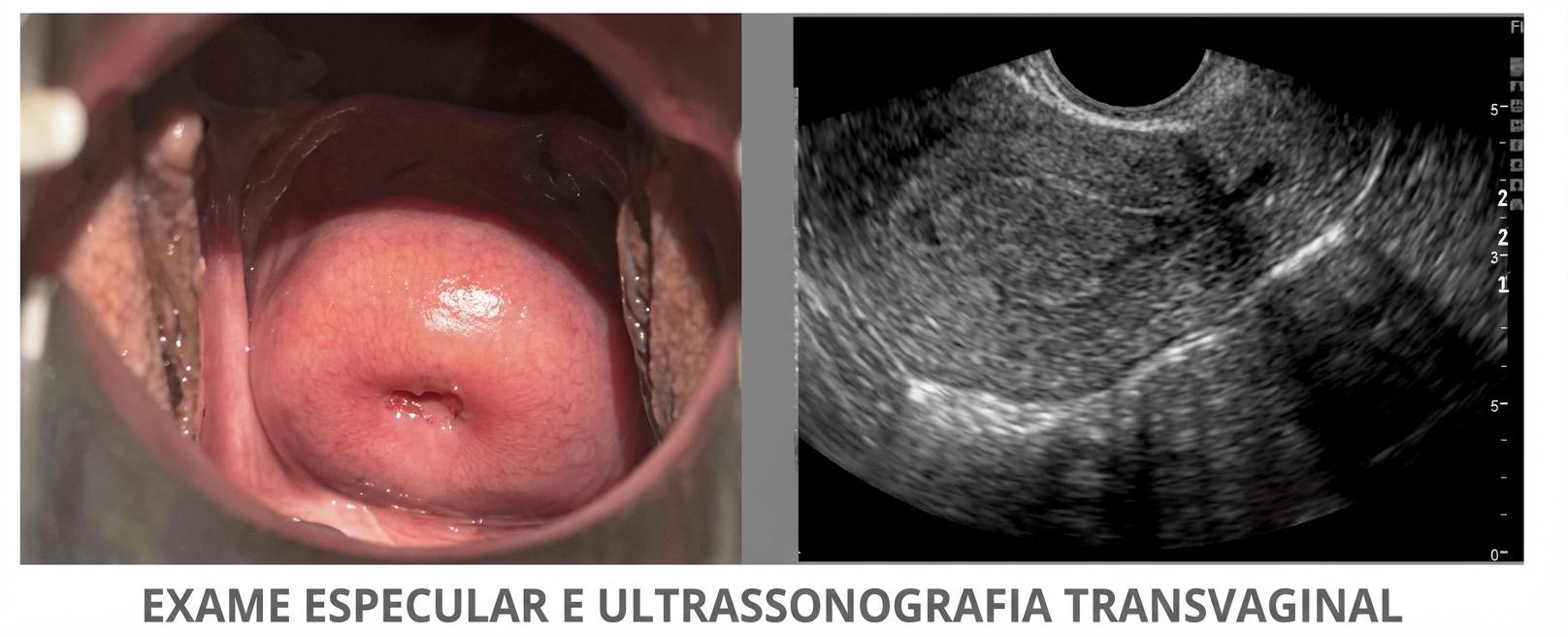 Imagem da questão de Climatério e menopausa