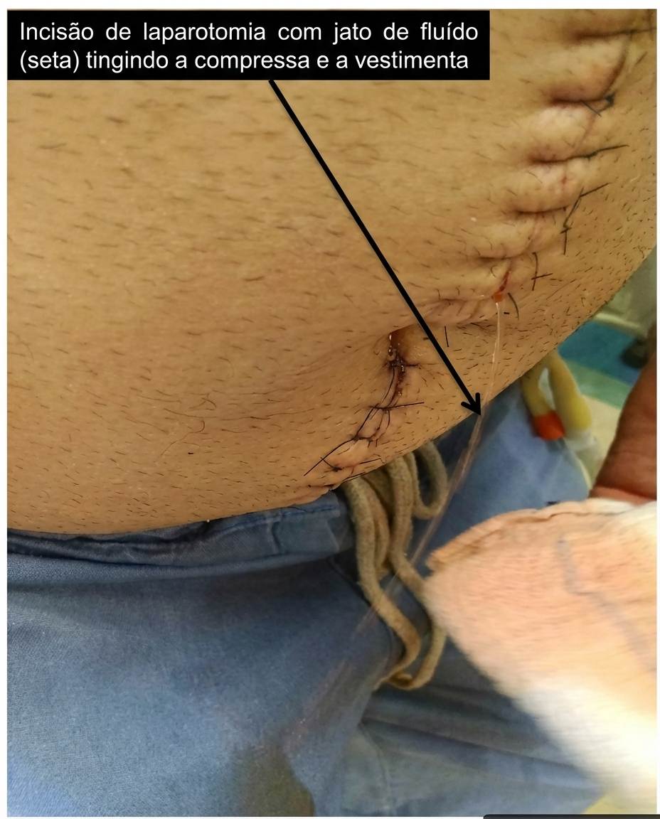 Imagem da questão de Avaliacão perioperatória